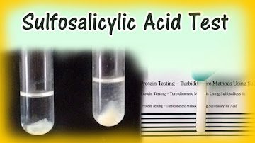 Bile Salts Test Principle And Procedure Hay S Test Method