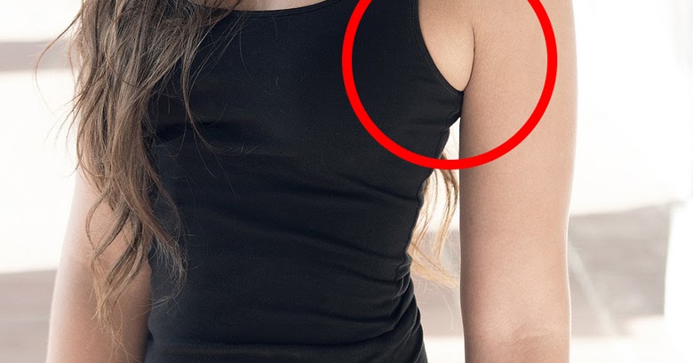 Гладкие подмышки. Черный акантоз под мышками. Ушить в плечах платье. Мокрые подмышки. Вырез под мышкой.