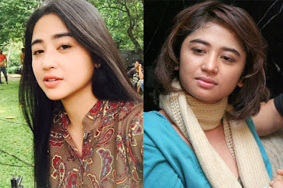 artis oplas tercantik artis operasi plastik terbaru artis operasi plastik tercantik artis operasi plastik terbanyak artis tanpa oplas artis taiwan oplas dada besar