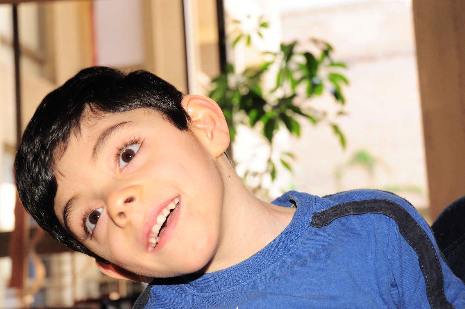 Chicos Especiales Síndrome de Lennox Gastaut