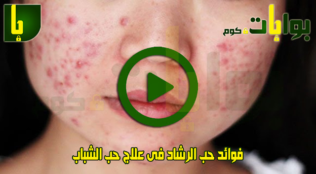 فوائد حب الرشاد فى علاج حب الشباب
