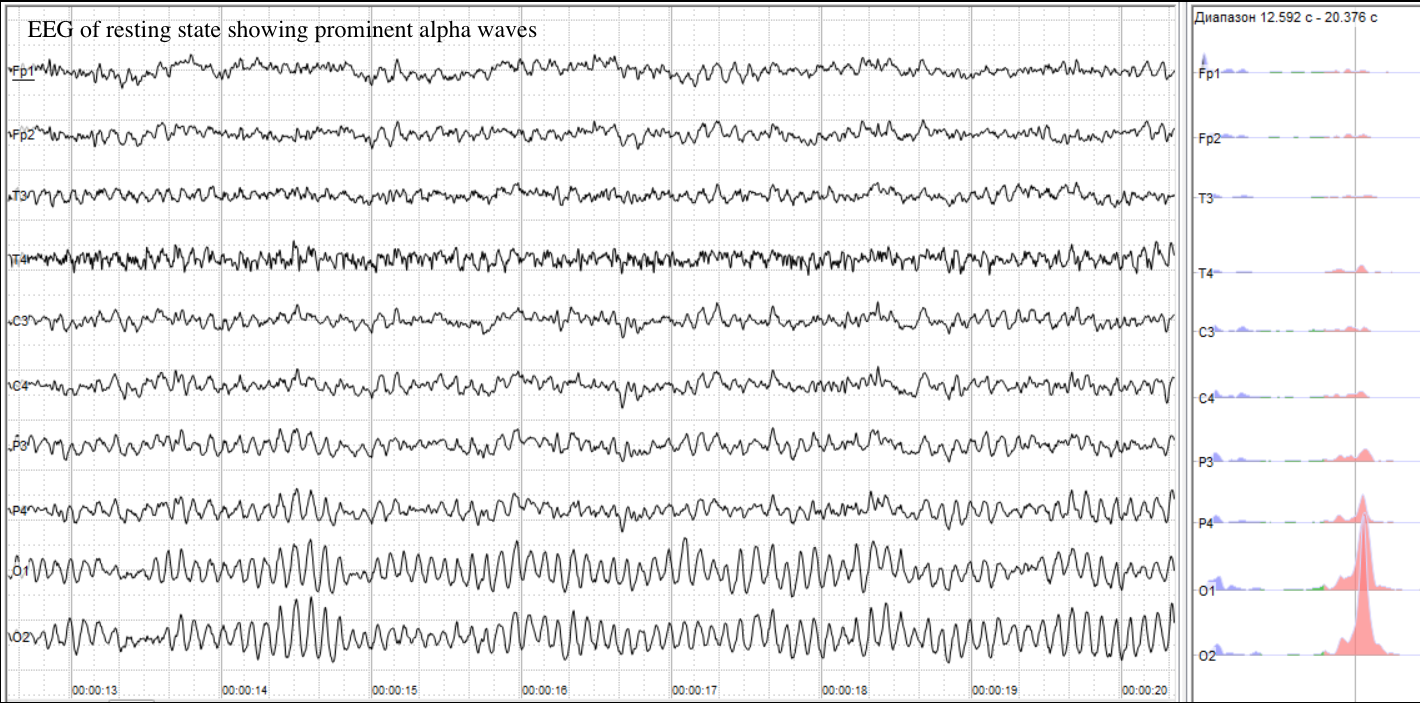 EEG Alpha waves