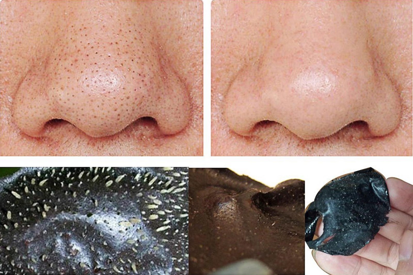 Диета против черных точек быстро Диета против черных точек быстро