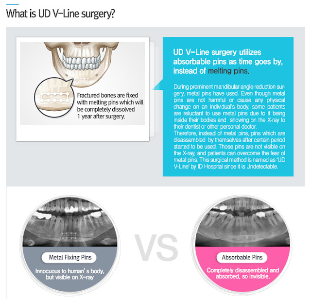 ID Hospital Korea Orthognathic surgery vs Facial contouring surgery