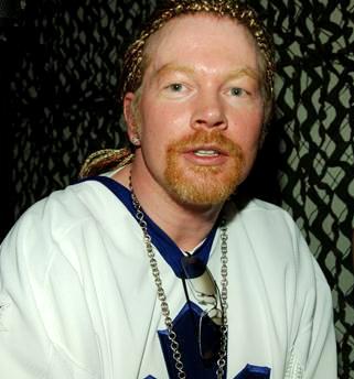 Axl Rose Foto de Axl Rose con cabello sujeto
