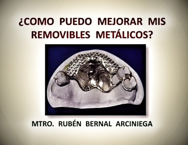 PRÓTESIS DENTAL: ¿Cómo puedo mejorar mis removibles metálicos? - Dr. Rubén Bernal Arciniéga