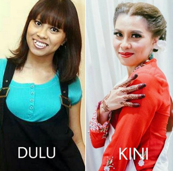 PASTI ANDA TAK PERCAYA! Inilah Perbandingan Wajah Artis Dahulu Dan Terkini Bikin Anda TERNGANGA PASTI ANDA TAK PERCAYA! Inilah Perbandingan Wajah Artis Dahulu Dan Terkini Bikin Anda TERNGANGA