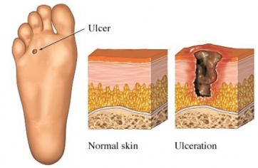 Clinical Diabetes