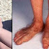 18 photos des pieds les plus étranges que vous ayez jamais vu! L'avant-dernière est à vomir!