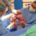 US Twin Baby Sisters Born Holding Hands