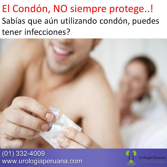 perforación euro oral sin condón perforación euro oral sin condón