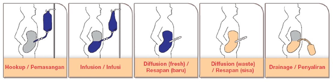 ASK DIS: February 2018