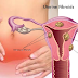 More Women Suffer From This Condition And Most Of Them Don't Know It Yet!
