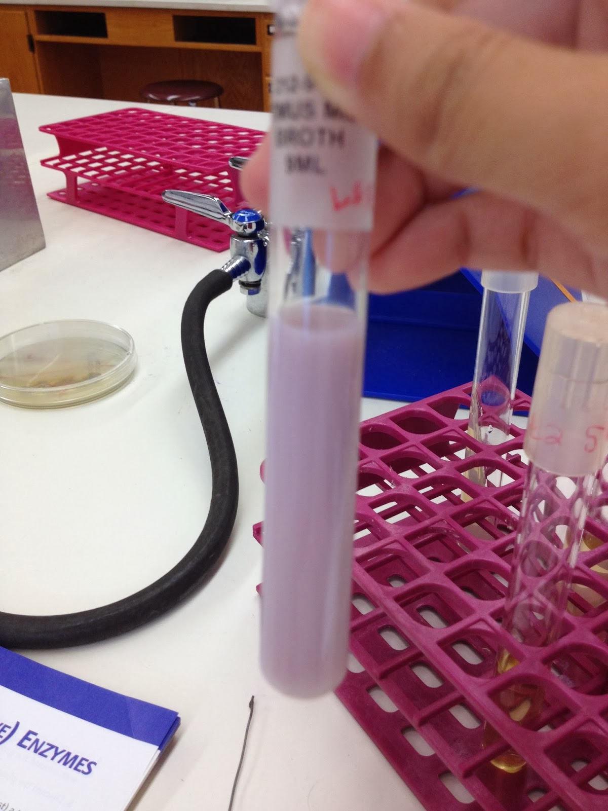 Rose Lindsey s Medical Microbiology Blog Litmus Milk Reactions rose-lindsey-s-medical-microbiology-blog-litmus-milk-reactions