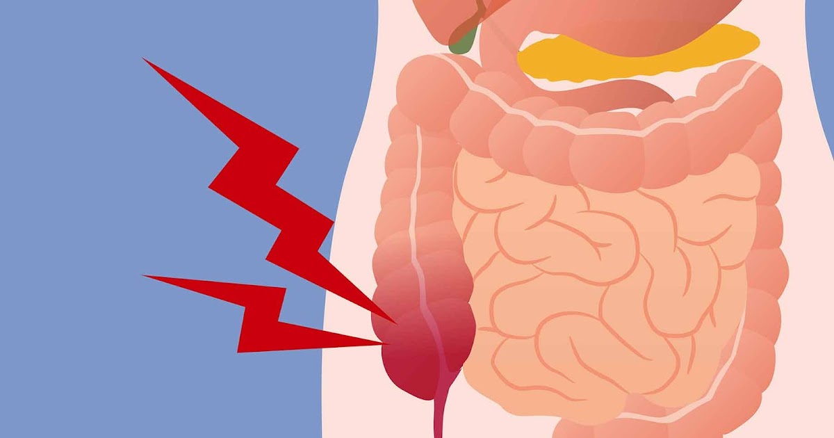 Get Rid Of 11 Lbs Of Waste From Your Colon With This Juice