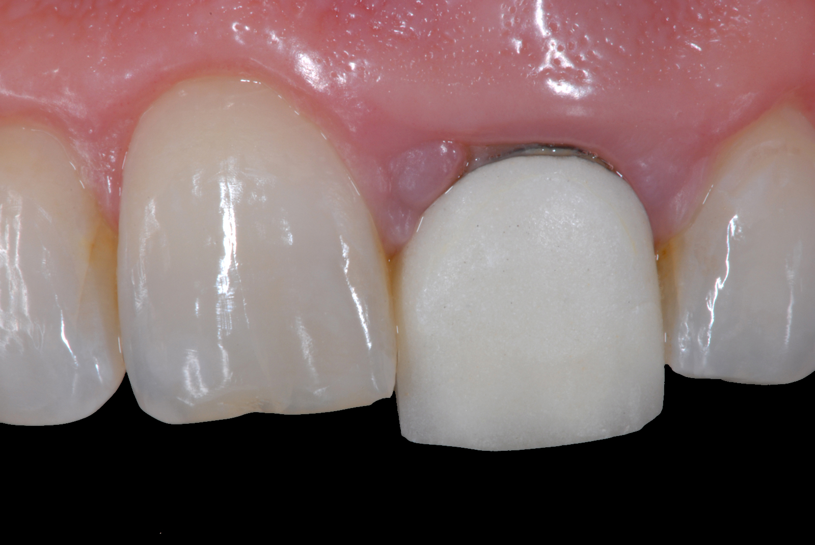 Dental Photography Pearls For Better Images Instantly An easy (and