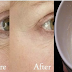 Surprising Way A Garlic Can Erase Wrinkles Forever