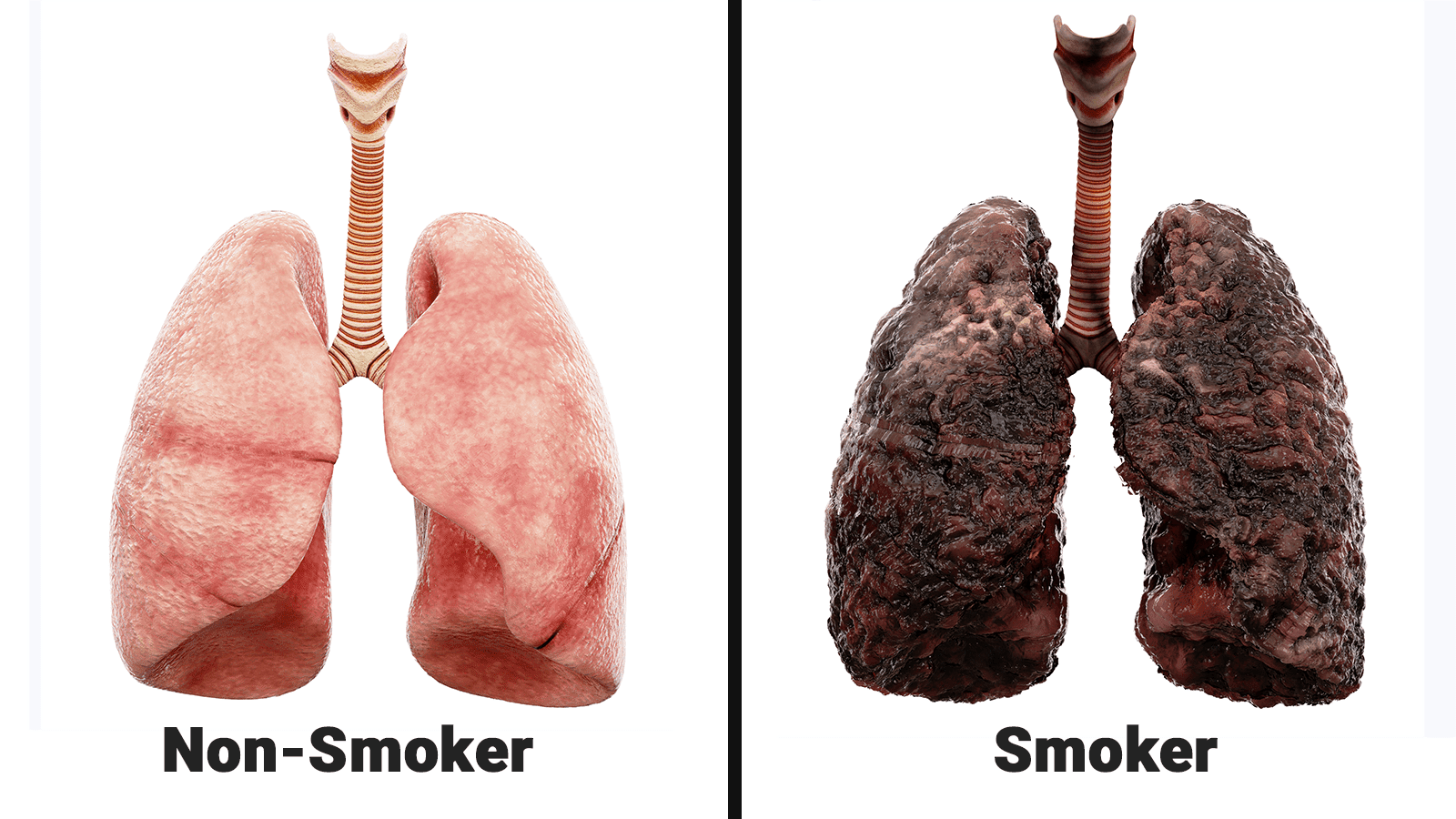 Nurse Explains What Smoking Does Every Day To Your Lungs