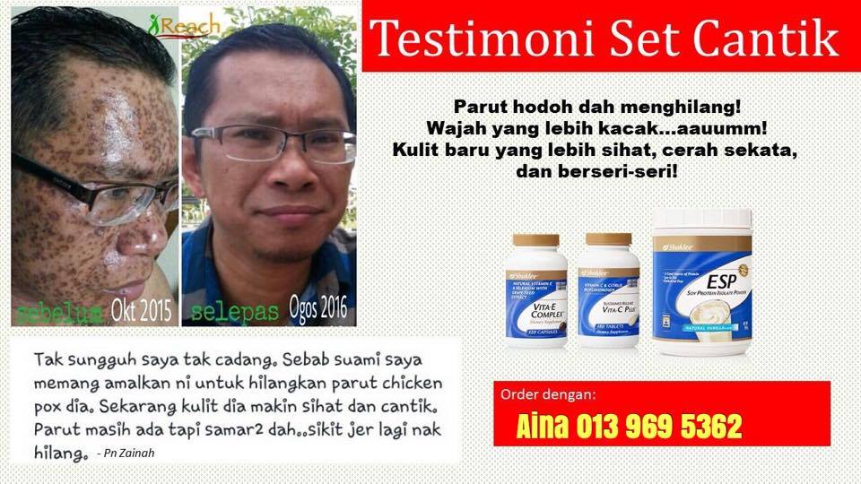 Kepentingan Vitamin C dan Vitamin E untuk kulit lebih cantik dan