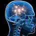 Marcapasos cerebral que puede prevenir enfermedades neurológicas