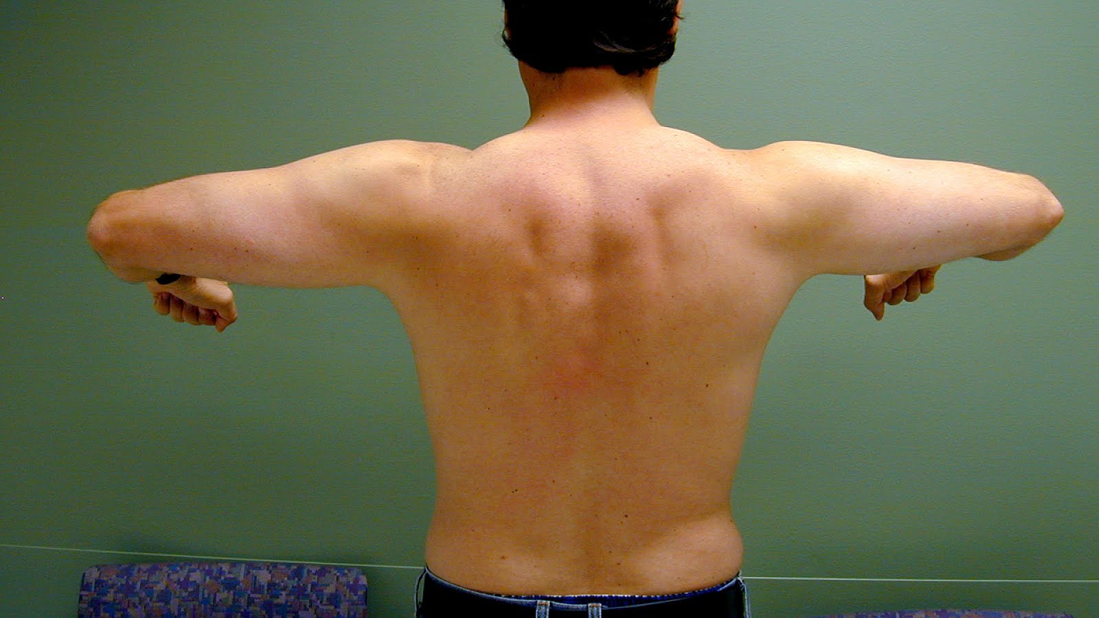 Scapular fracture Scapula Injuries Injury Injury Choices