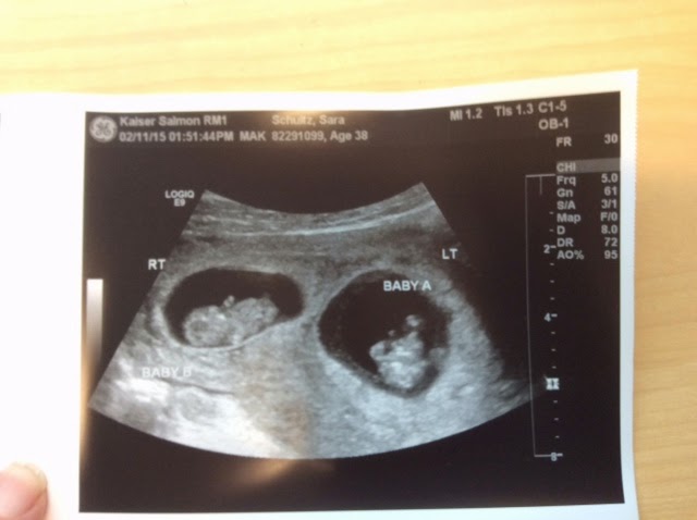 10 недель близнецы