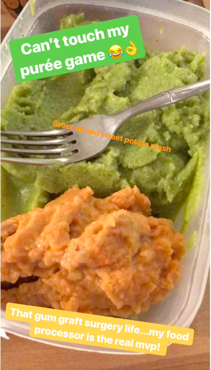 The Best Gluten Free And Vegan Soft Foods To Eat After Dental
