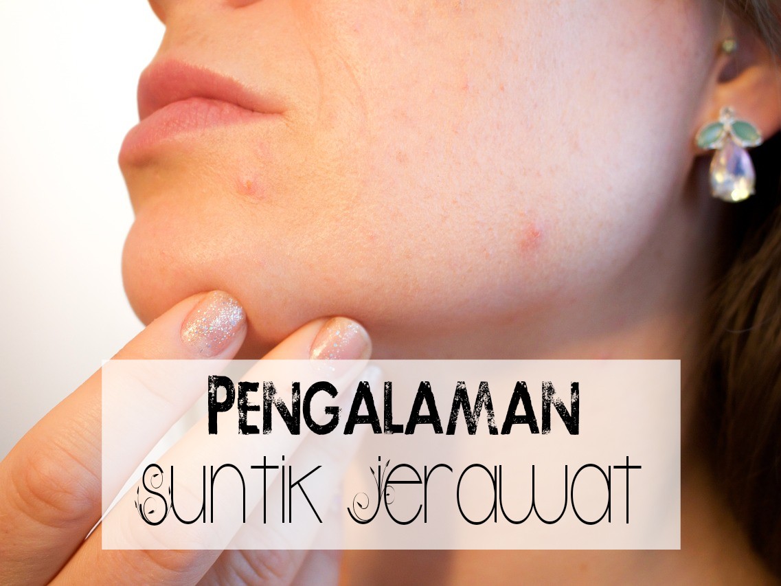 Pengalaman Suntik Jerawat