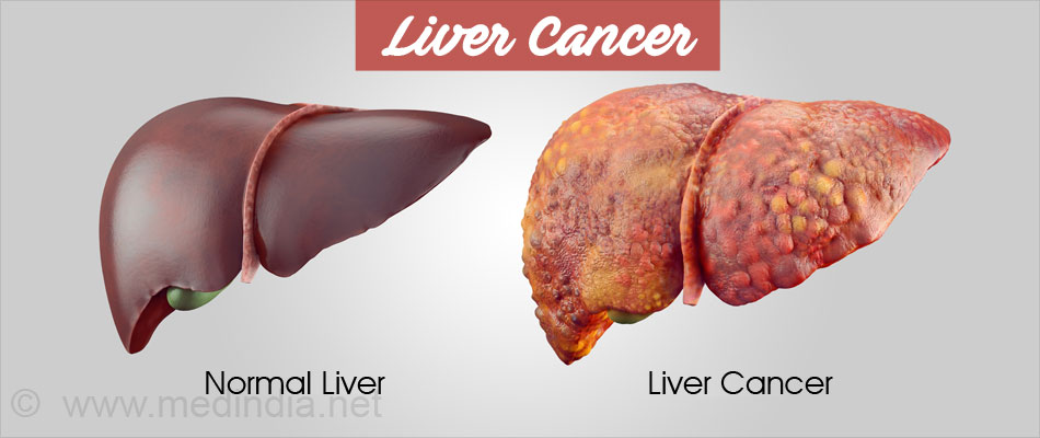 Food And Drink Good For Liver Food And Drink Good For Liver