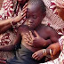 ABSURDO: Cerca de 60 meninas foram internadas após sofrerem mutilação genital
