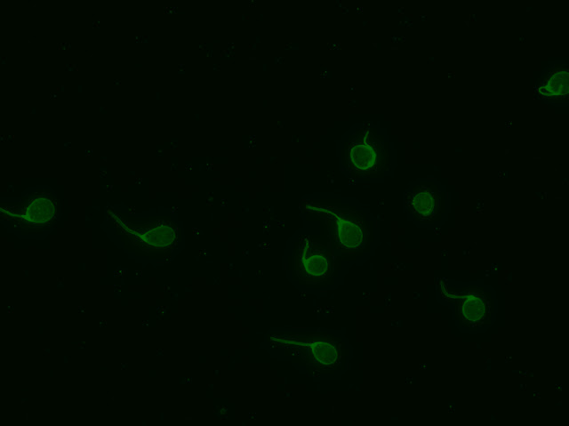 Crithidia (IFI) - Ausência de fluorescência no cinetoplasto (diluição 1:10)