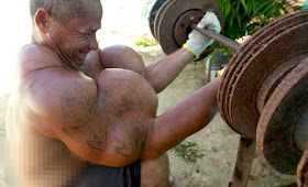 جنون الشهرة: رجل يخاطر بحياته من تضخيم عضلاته!