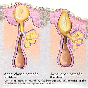 The Right Skin Care Steps To Take