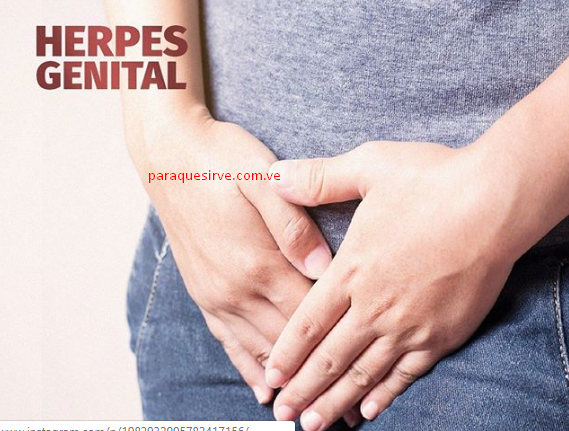 Como curar el herpes genital