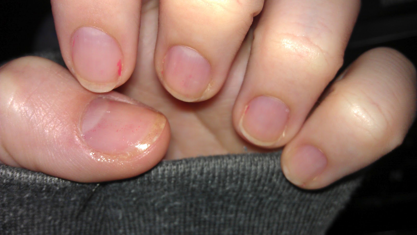 Leanne Marie Two Week Nail Growth Project