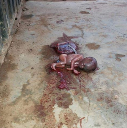 New born baby abandoned in Abuja immediately after delivery with its placenta still attached (graphic photo)