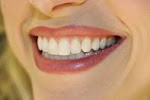 How to Whiten Teeth by Peroxide picture image photo pic image img
