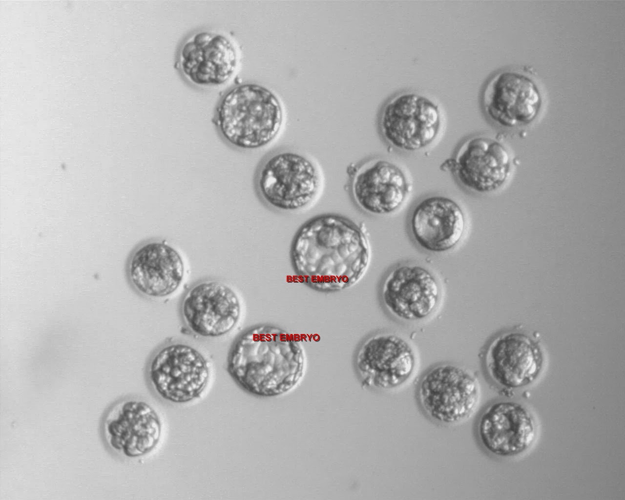 Grading IVF embryos The IVF Specialist's Blog for IVF patients