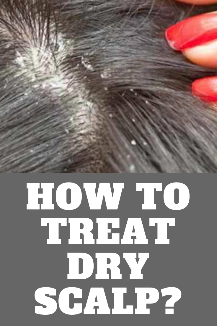 How to Treat Dry Scalp? All For You