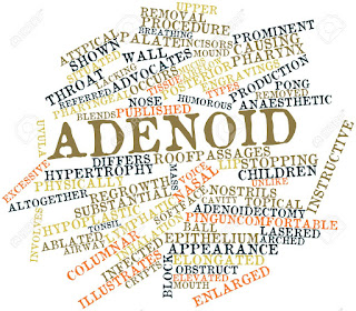 adenoid-www.healthnote25.com