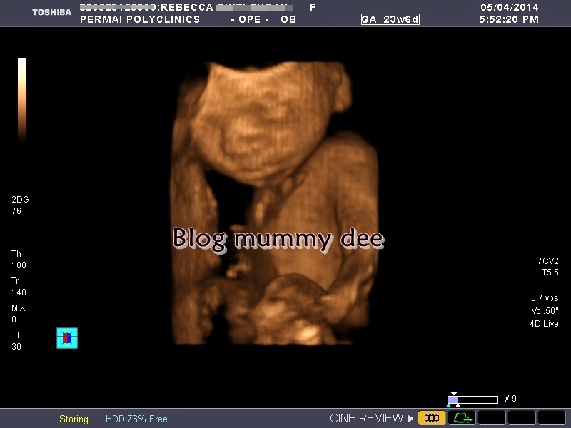 Blog Mummy Dee Scan 3D/4D di Kota Kinabalu, Sabah