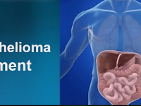 Mesothelioma Lawyer - Is This The Cure To Mesothelioma Cancer? Mesothelioma Lawyer - Is This The Cure To Mesothelioma Cancer?