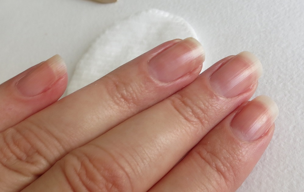 почему тонкие ногти на руках