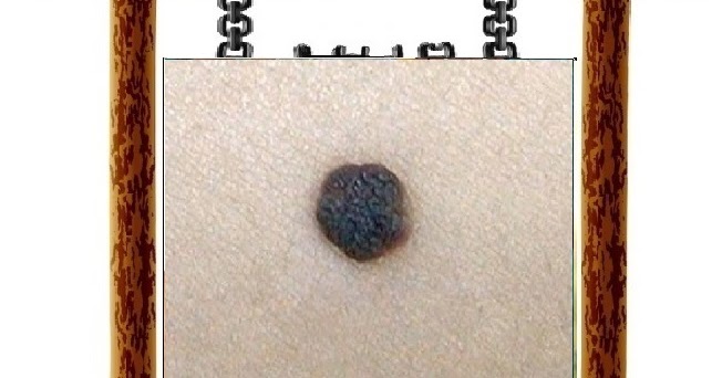 bensağlık Rahimde Et Beni Hakkında Önemli Bigiler