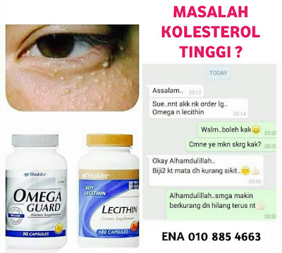 Bintik-bintik kolesterol berkurangan selepas konsisten amalkan Set Kolesterol Shaklee Omega Guard dan Lecithin