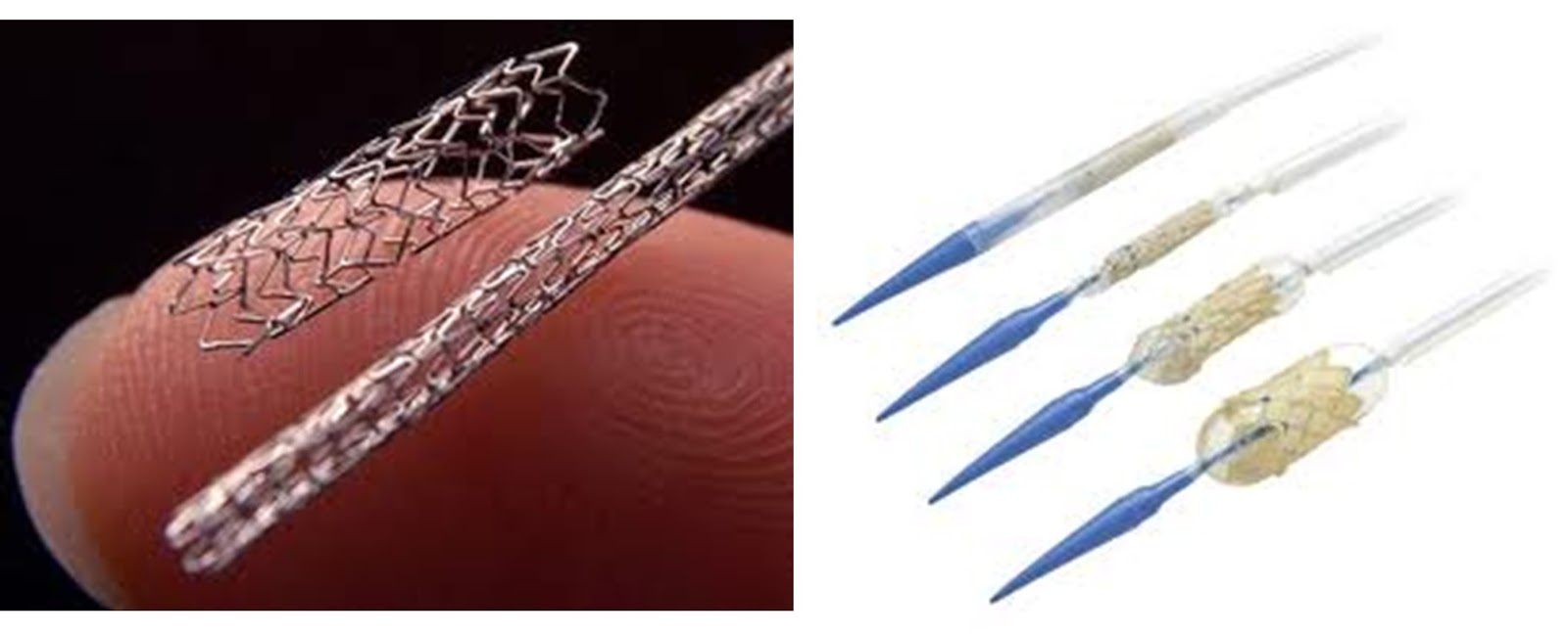 Bilderesultat for stent