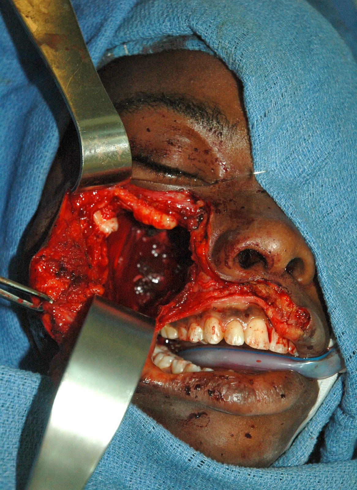 Earthwide Surgical Foundation: October 2013