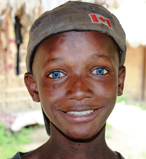 Acting White Acting Black Blue Eyed African Boy From