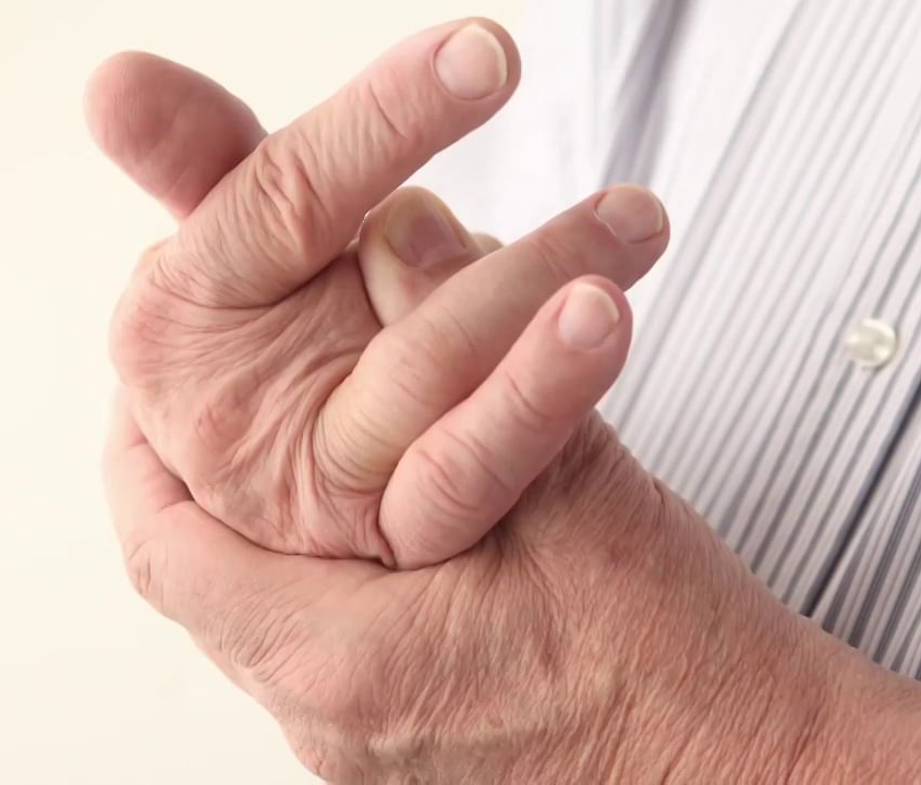 手抖眼突脖子粗　甲狀腺亢進治療免挨刀