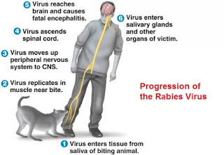 rabies-www.healthnote25.com